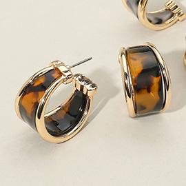Tortoiseshell Celluloid Acetate Hoop Earrings